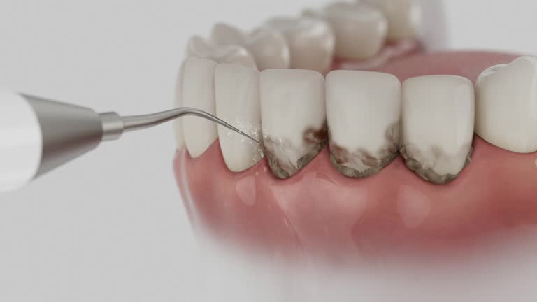 Reliable Dental contractor in Carey, OH by Dentist Open Now